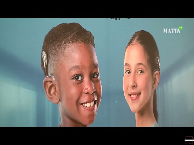   1er Congrès africain sur l’implantation cochléaire de l’enfant: Pour une politique auditive unifiée  